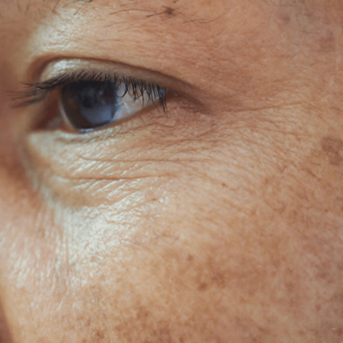 Skin Age